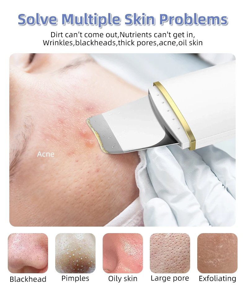 Facial Blackhead Remover Electric Acne Ultrasonic Facial Cleaner Electric Ultrasonic Skin Scrubber Spatula