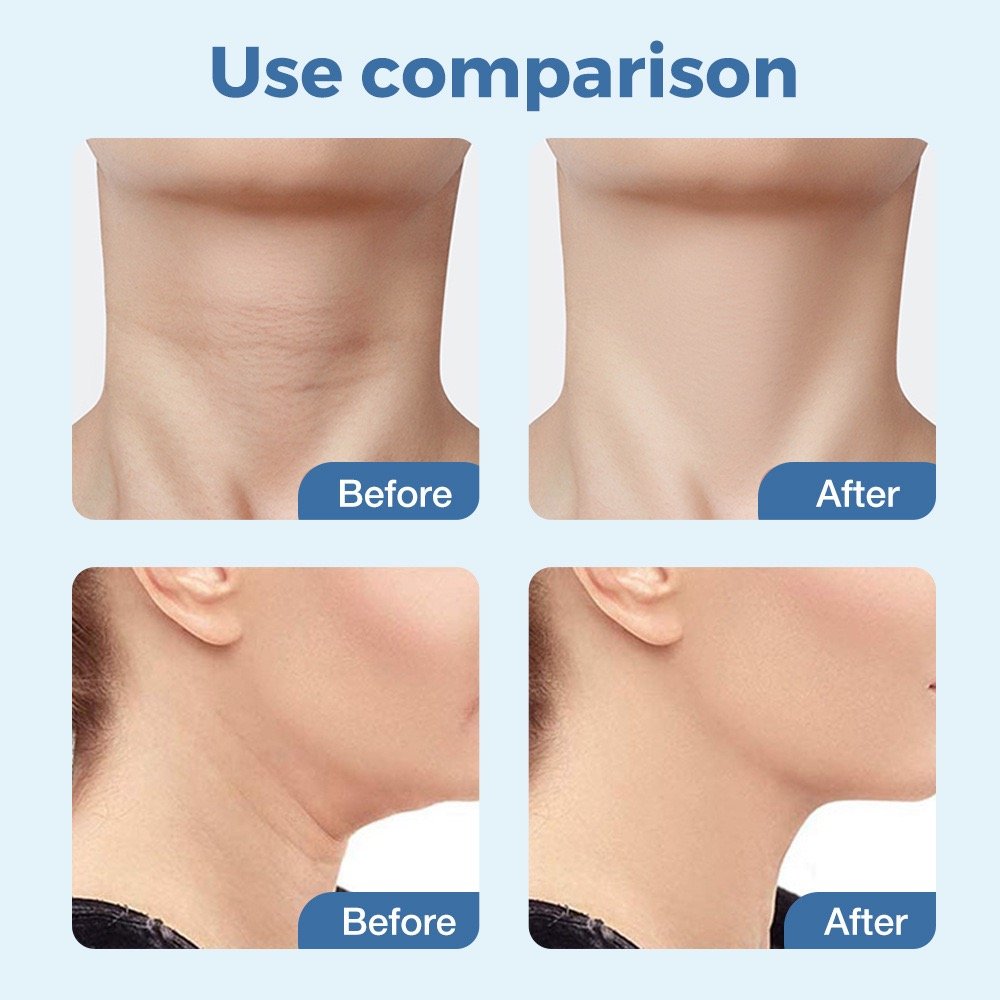Home EMS micro-current surface neck massager Skin care beauty anti-wrinkle lift neck heating vibration beauty tool 