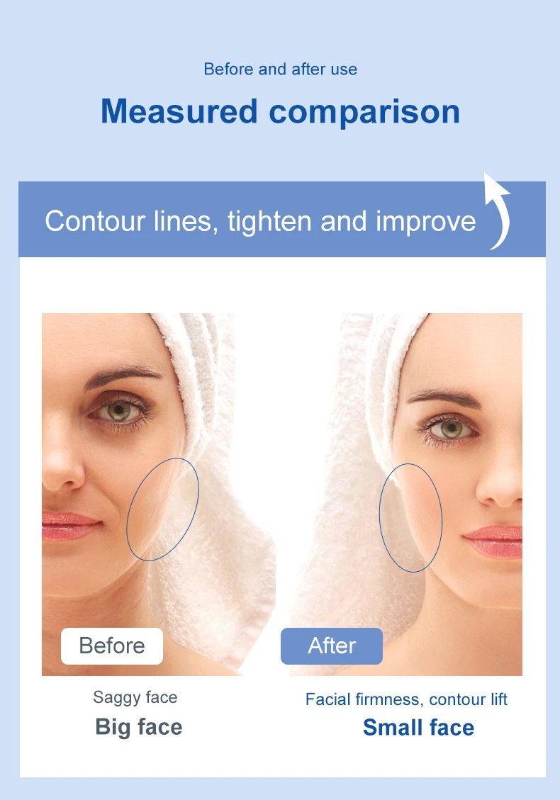 Home Use EMS Microcurrent Facial Massage Instrument Electric Face And Neck Lift Massager
