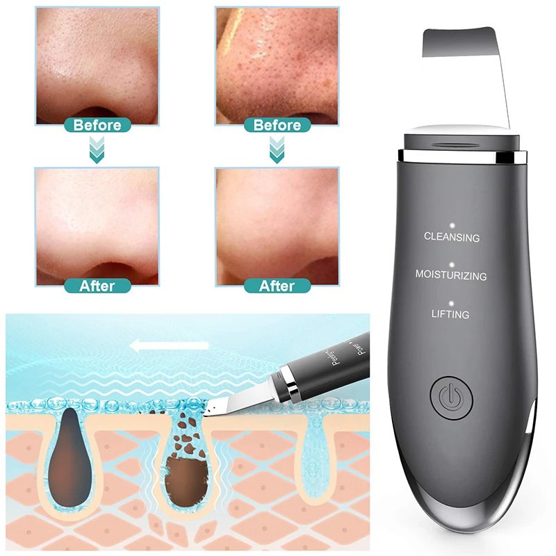 Electric Face Exfoliator Device Facial Ultrasonic Skin Scrubber Blackhead Remover