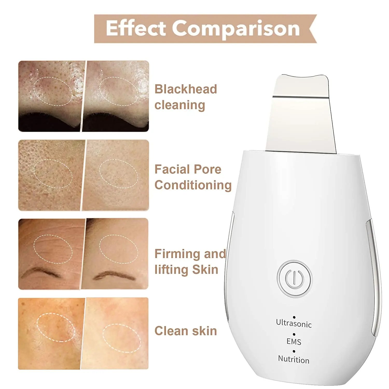 Face Deep Cleansing Skin Scrubber Ultrasonic EMS High Frequency Face Cleaning Machine