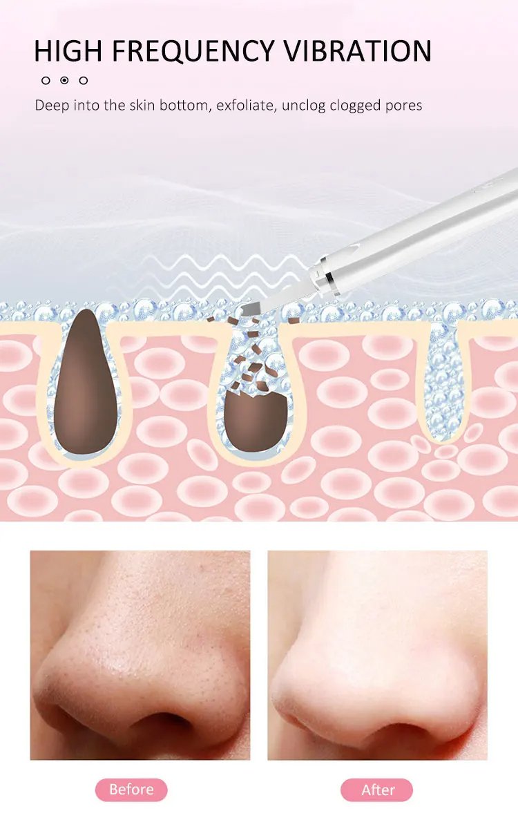 Professional Face Exfoliating Device Peeling Sonic Face Skin Spatula Deep Cleansing Ultrasonic Facial Skin Scrubber