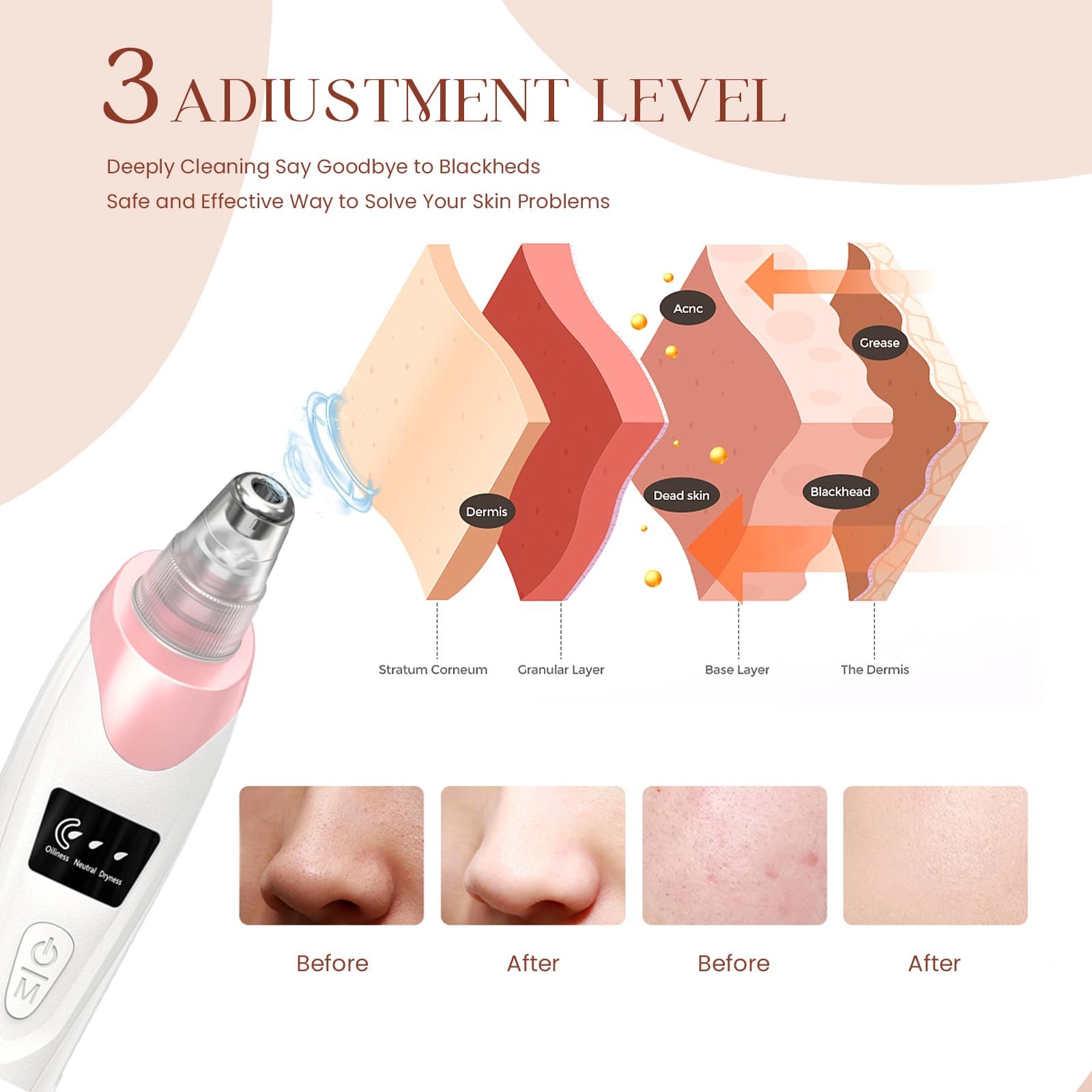 Electric Facial Cleansing Nose Vacuum Suction Blackhead Removal Tool Deep Cleaning Facial Pore Cleaner