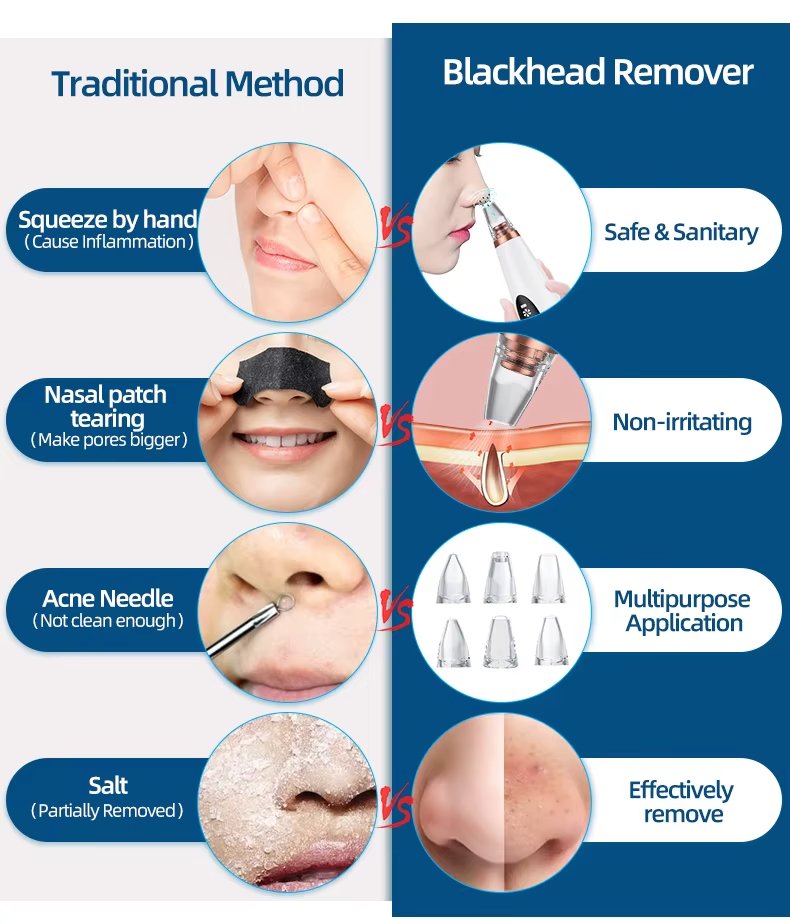 Nose Face Deep Pore Cleaner Blackhead Remover Tool