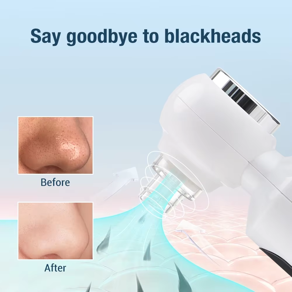 2 In1 Blue Light Deep Cleansing Vacuum Pore Face Cleansing Tool with Heating Mode