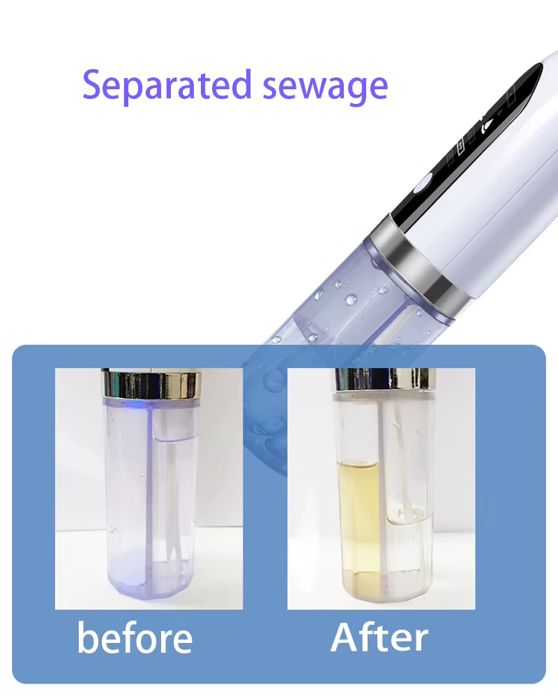 Electric Cleaner Mini Facial Skin Pore Micro Small Bubble Water Cycle Acne Vacuum Blackhead Remover