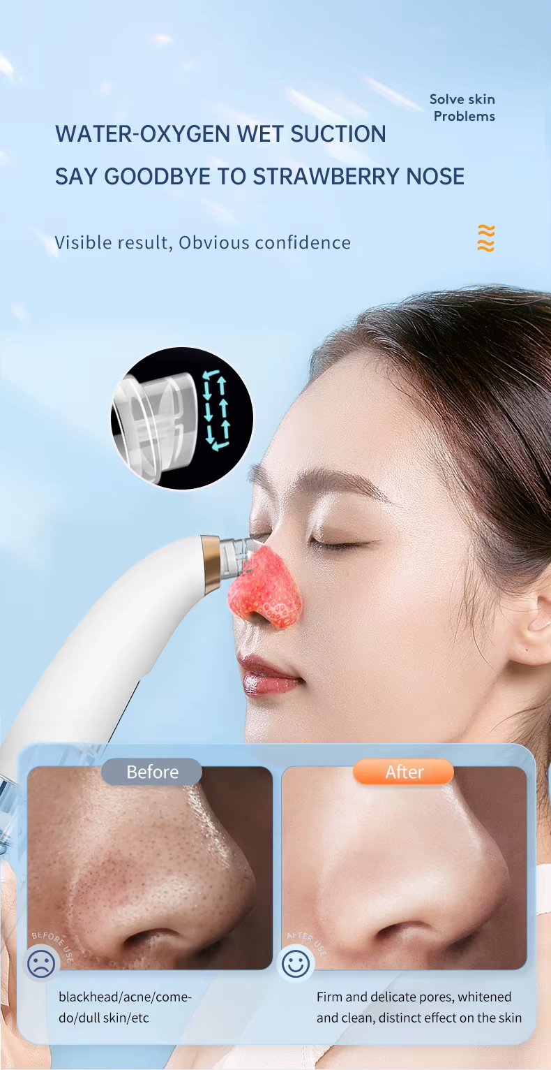 Pore Extractor Small Bubble Mini Facial Cleaner Water Vacuum Blackhead Remover